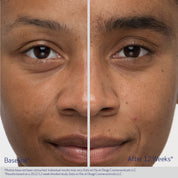Obagi Medical OBAGI NU-CIL® EYEBROW BOOSTING SERUM
