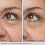 Obagi Medical DAILY HYDRO-DROPS® REJUVENATING EYE GEL CREAM