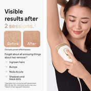 Braun Silk Expert Pro 5 IPL
