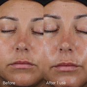 Image Skincare Ultra Defense SPF 50