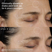 ELM Biosciences A3O™ Elemental Night Serum