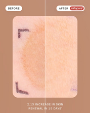 Timeline Mitopure Resurfacing Exfoliator