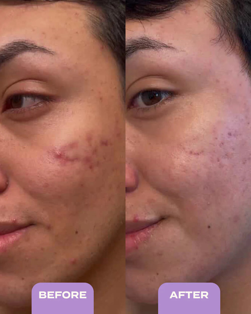 Banu Blemish Control & Exfoliating Serum