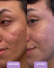 Banu Blemish Control & Exfoliating Serum