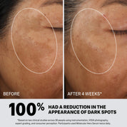 Mother Science Molecular Hero Dark Spot Serum