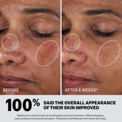 Mother Science Molecular Hero Dark Spot Serum