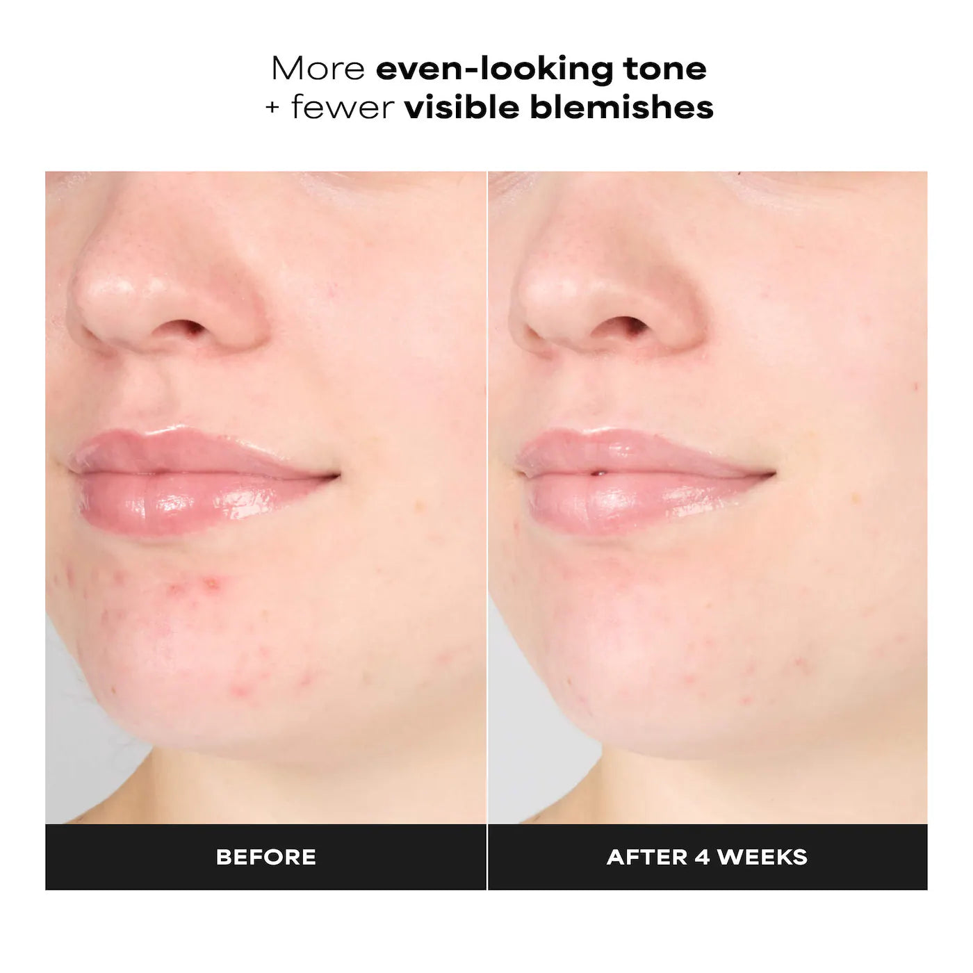 Paula's Choice 1% BHA Gentle Exfoliating Gel Toner