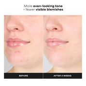 Paula's Choice 1% BHA Gentle Exfoliating Gel Toner